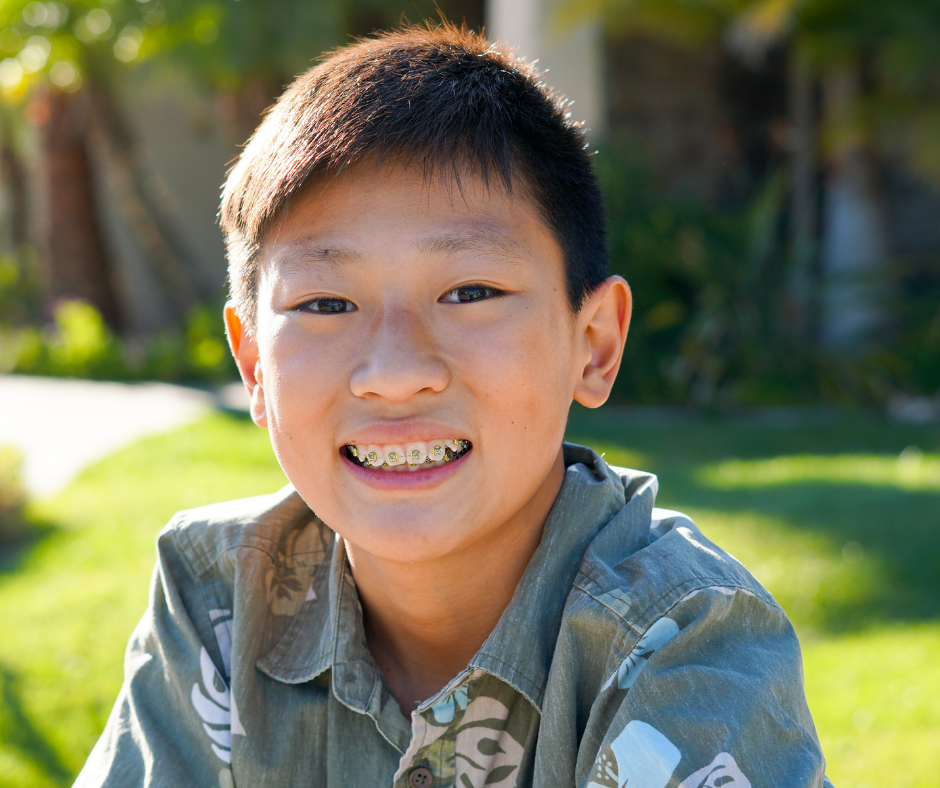 More Than Straight Teeth: Why Orthodontics for Children Are So Important